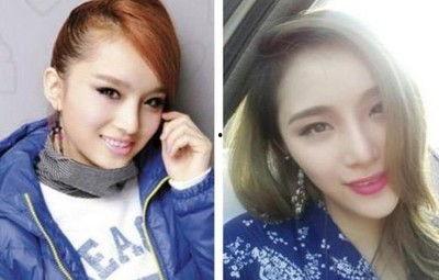 卢媛媛整容前的照片,从素颜到惊艳的美丽逆袭